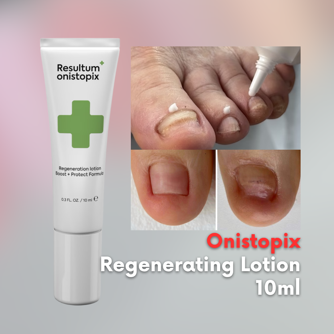 NAILSOFTHEDAY Resultum Onistopix Lotion – Regenerating Nail Lotion, 10ml
