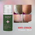 NAILSOFTHEDAY Resultum Anti-Crack Cream with Jojoba, 25ml