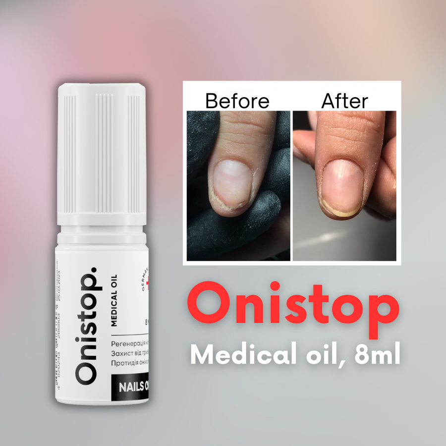 NAILSOFTHEDAY Onistop Medical Oil,15ml