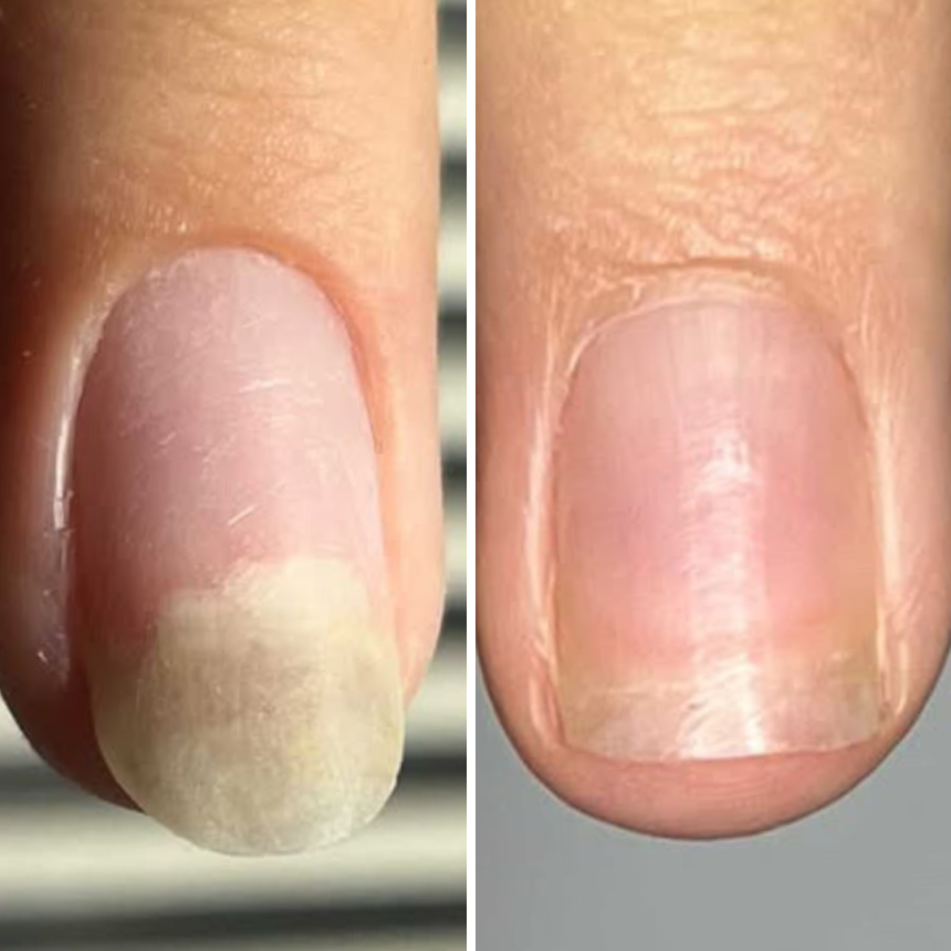 NAILSOFTHEDAY Resultum Onistopix Oil, 8ml