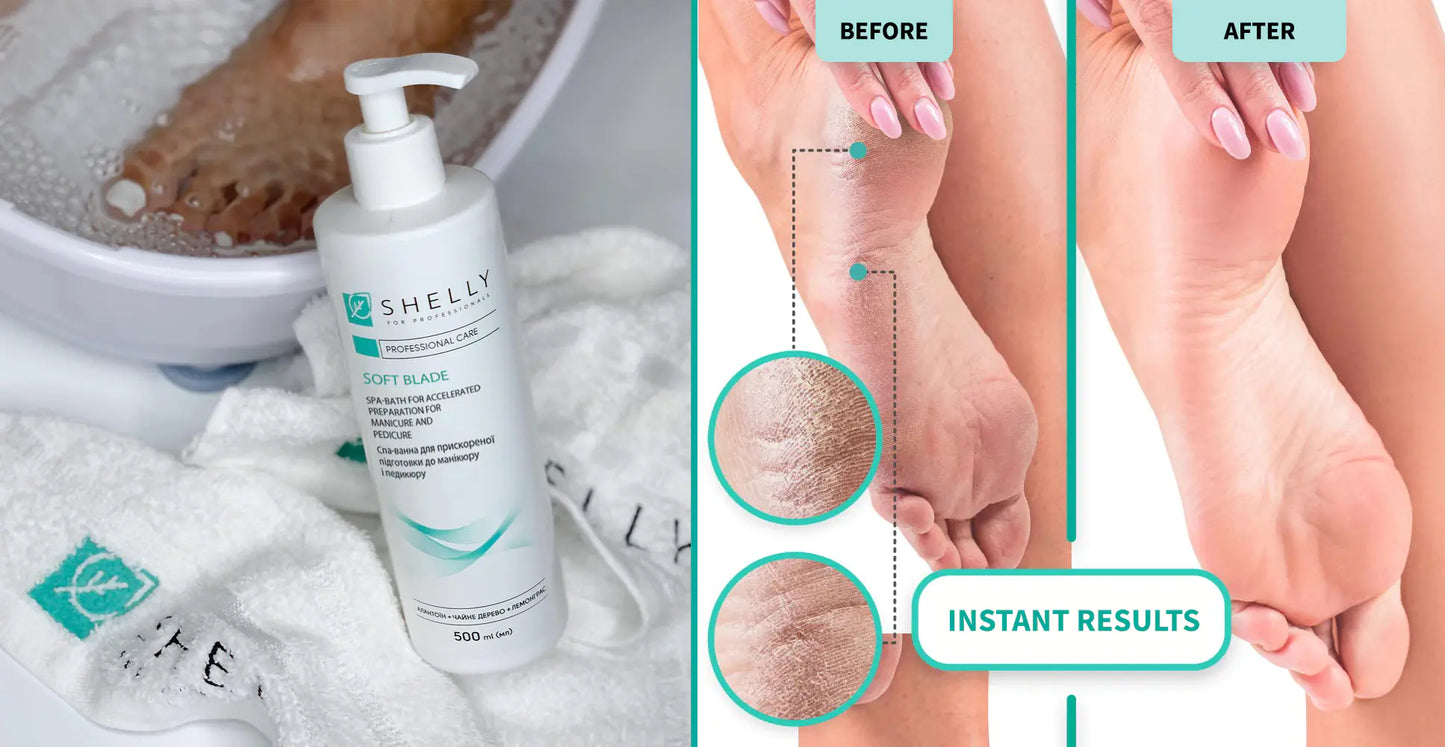 Shelly "Soft Blade" Keratolytic Gel, 200ml