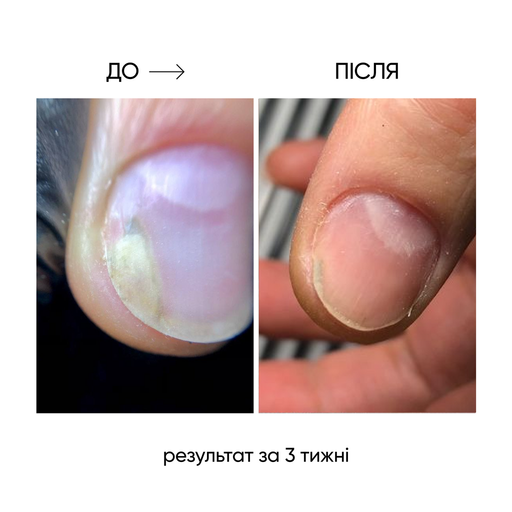 nail care grooming