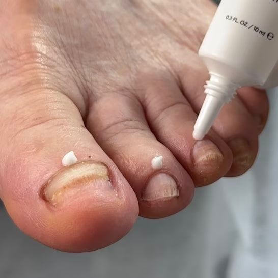 NAILSOFTHEDAY Resultum Onistopix Lotion – Regenerating Nail Lotion, 10ml