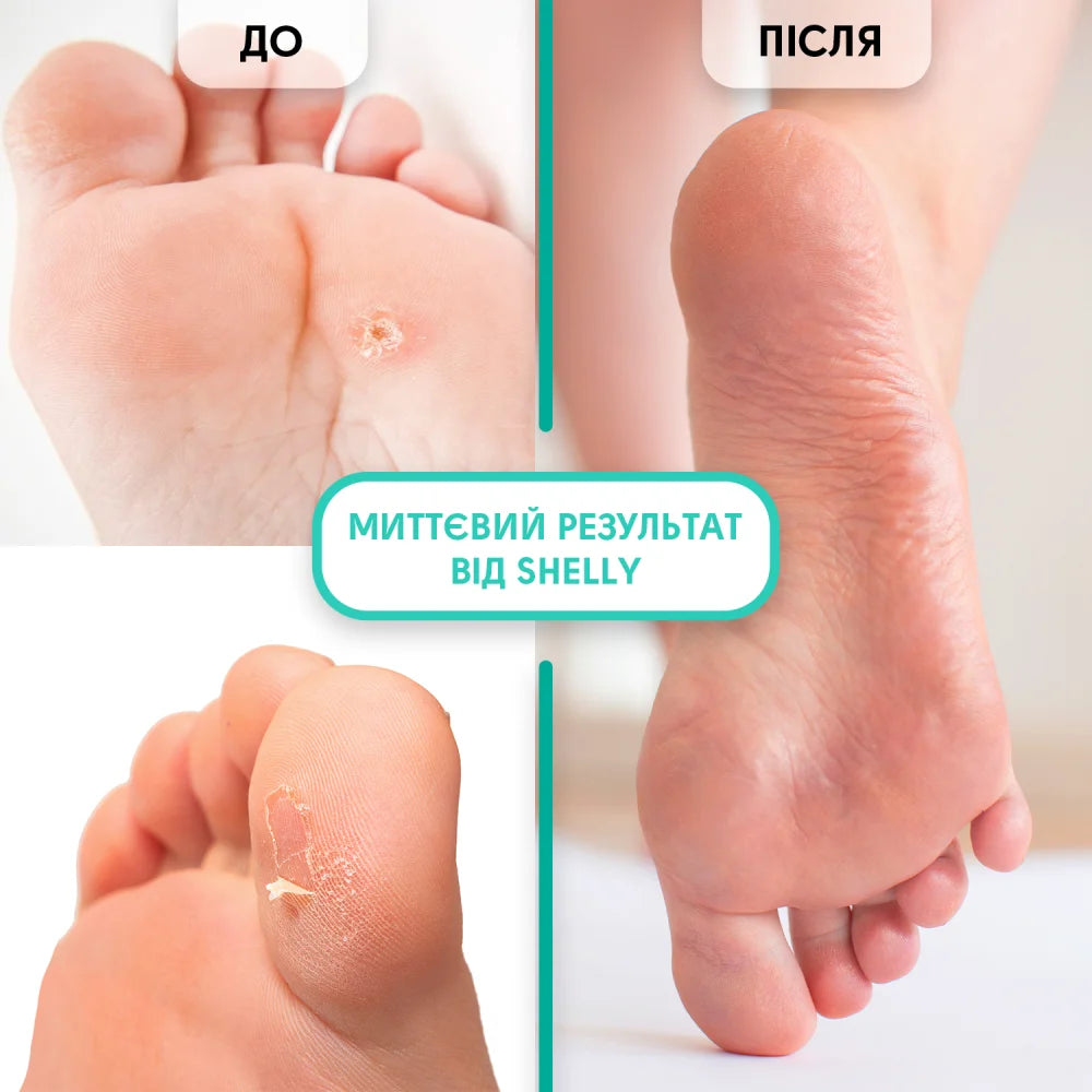 Shelly "Soft Blade" Foot Callus Softening Gel, 100ml